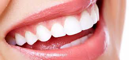Diş Beyazlatma Nasıl Yapılır?